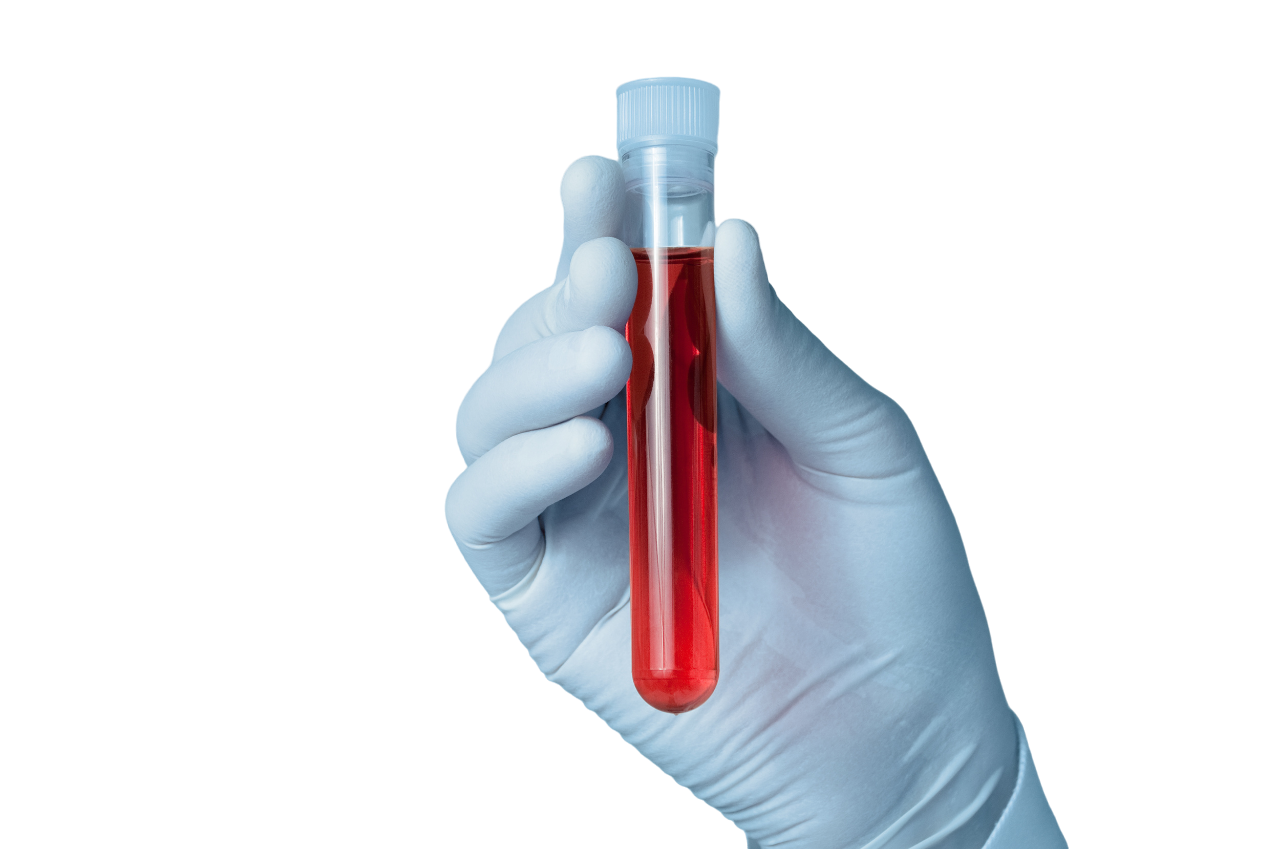 Биохимический анализ крови (23 показателя)