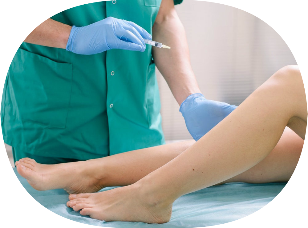 Склеротерапия вен