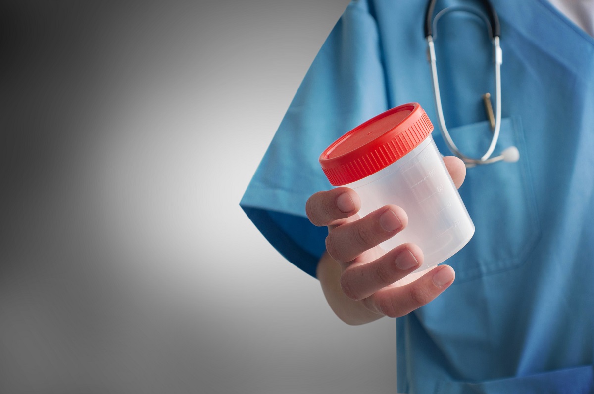 Подготовка к сдаче анализов мочи