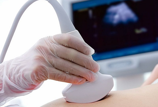 Вызов УЗИ на дом